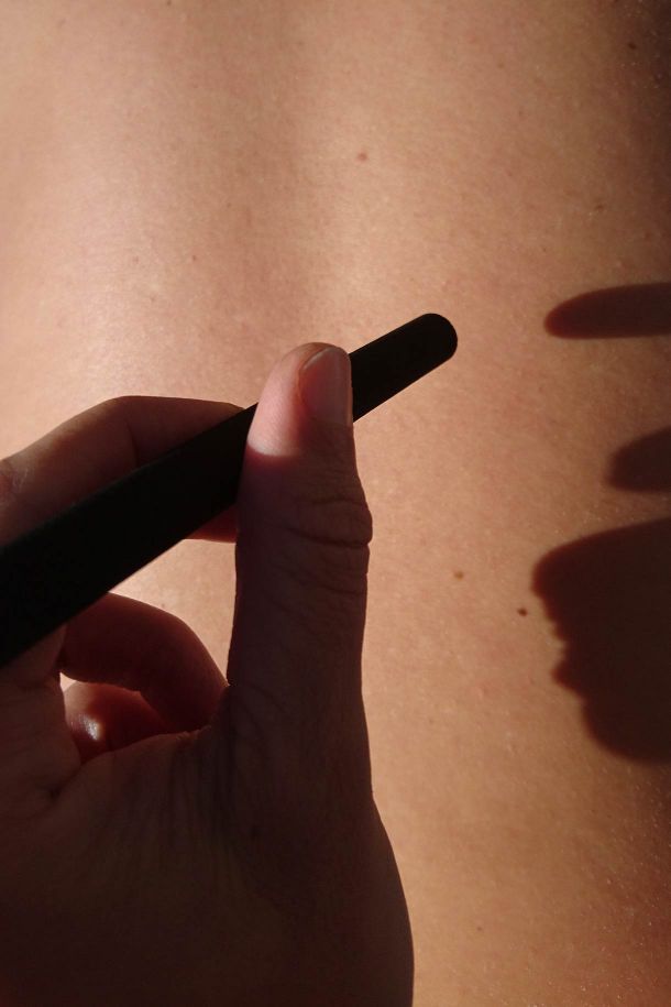 Moxibustion à Rennes